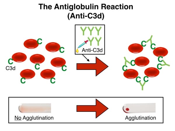 C3d Coated RBCs with Anti-C3d