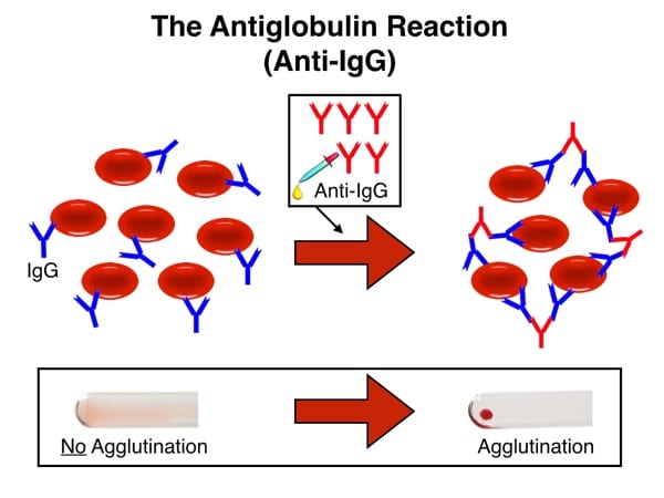 IgG-coated RBCs and anti-IgG