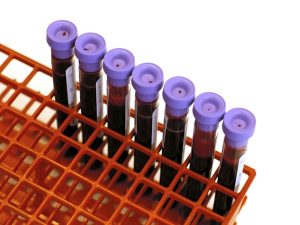 Blood samples for lab work