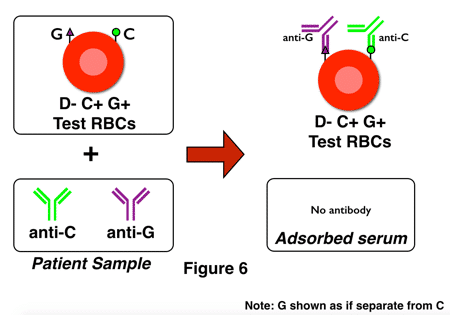 G differentiation shortcut-patient 1