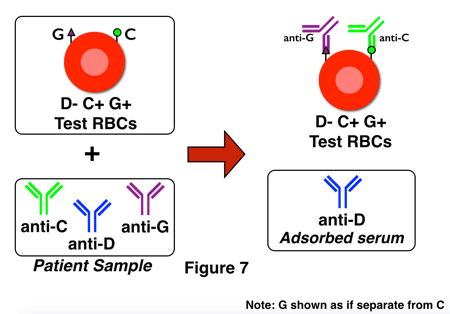 G differentiation shortcut-patient 2