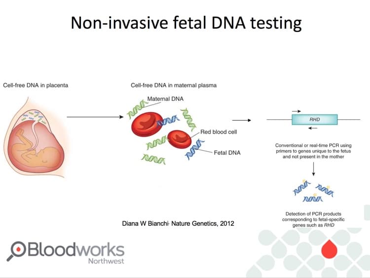Delaney Slide 17 - Non-invasive fetal DNA testing