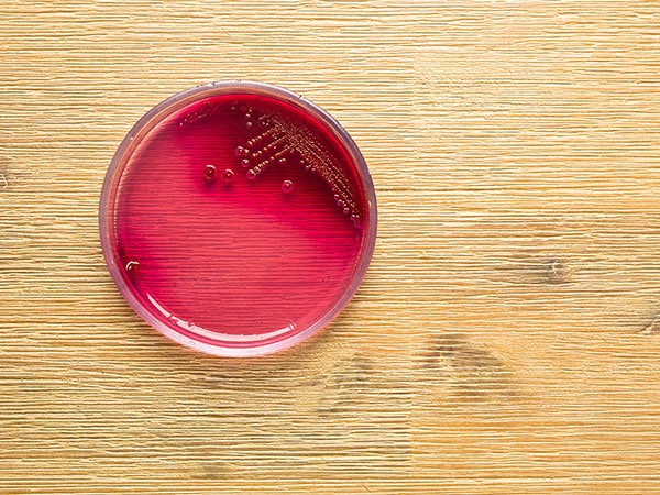 076 Featured image bacteria in culture