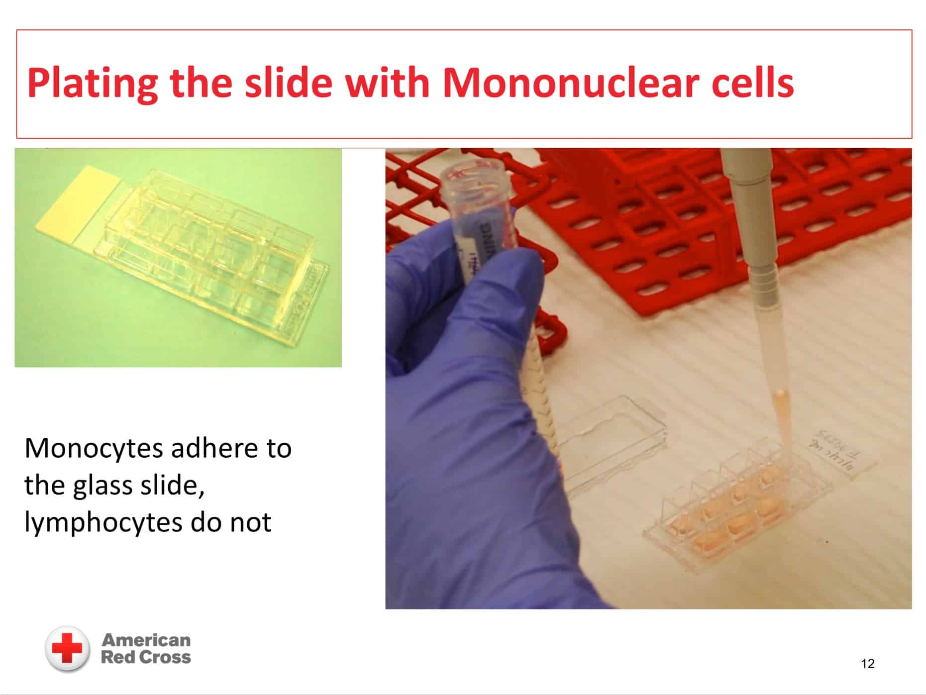 Monocyte monolayer assay image 