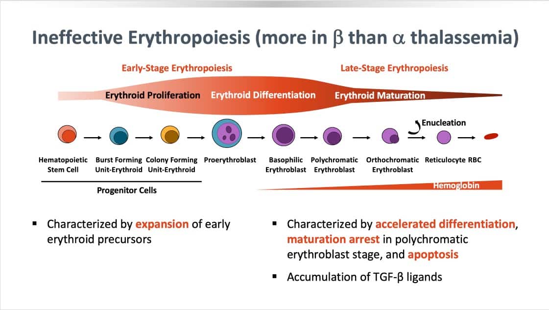 Slide 2 - Ineffective erythropoiesis; note expansion of early precursors